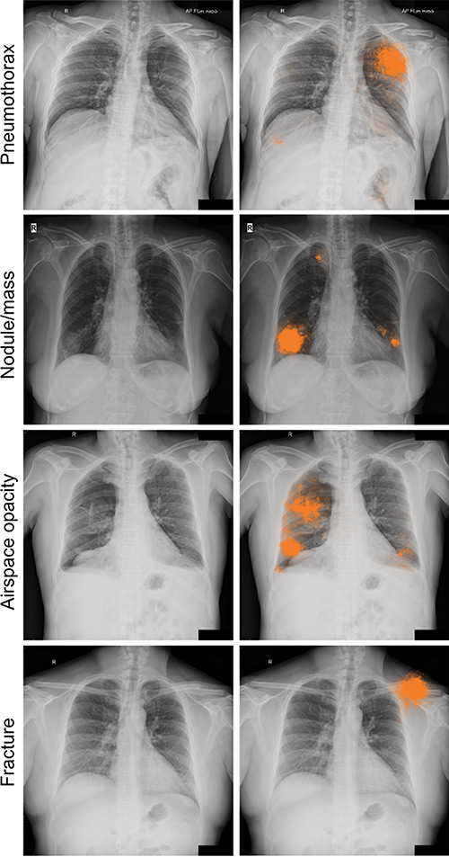 Precision Insights: Radiology Interpretation Unveiled