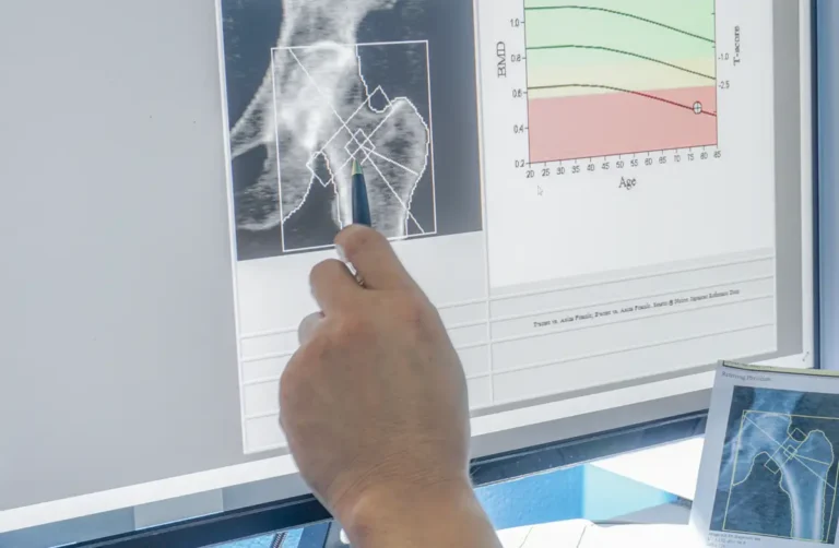 DR News: To the Bone
