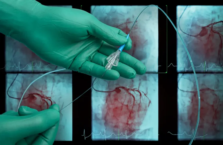 Flexible Fluoroscopy