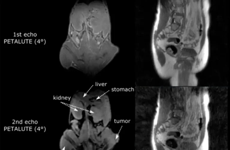 MRI Monitor: In Sequence