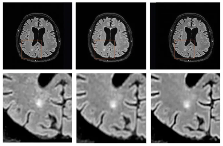 MRI Monitor: A Quick Look