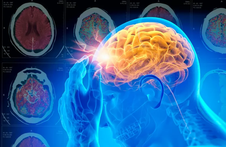Examining TBI